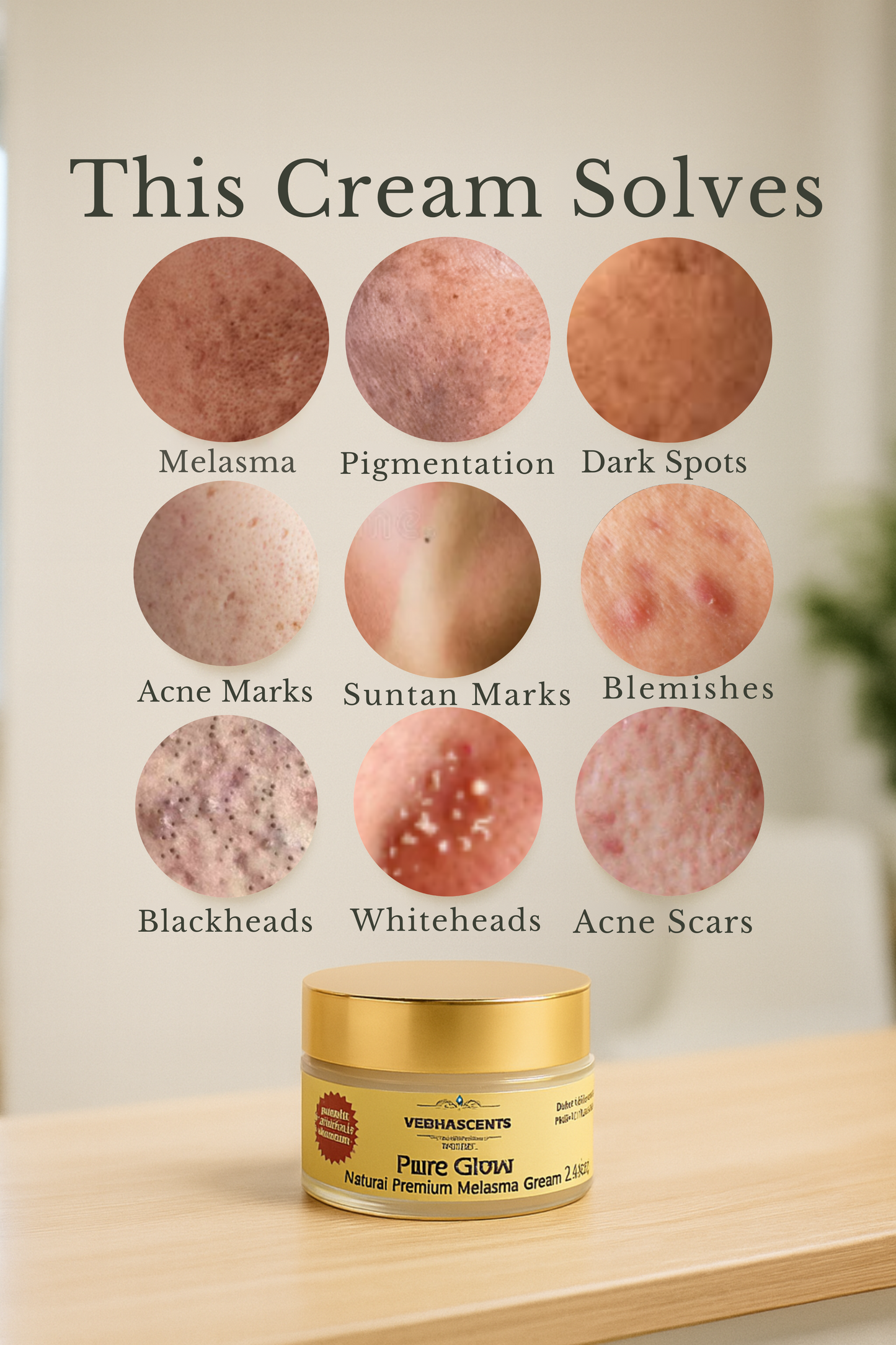 Vedhascents Premium Natural Melasma Cream|Pigmentation & Dark Spots | Acne Marks, Suntan Marks, Blackheads & Whiteheads | Ayurvedic Night Face Cream (20 g)