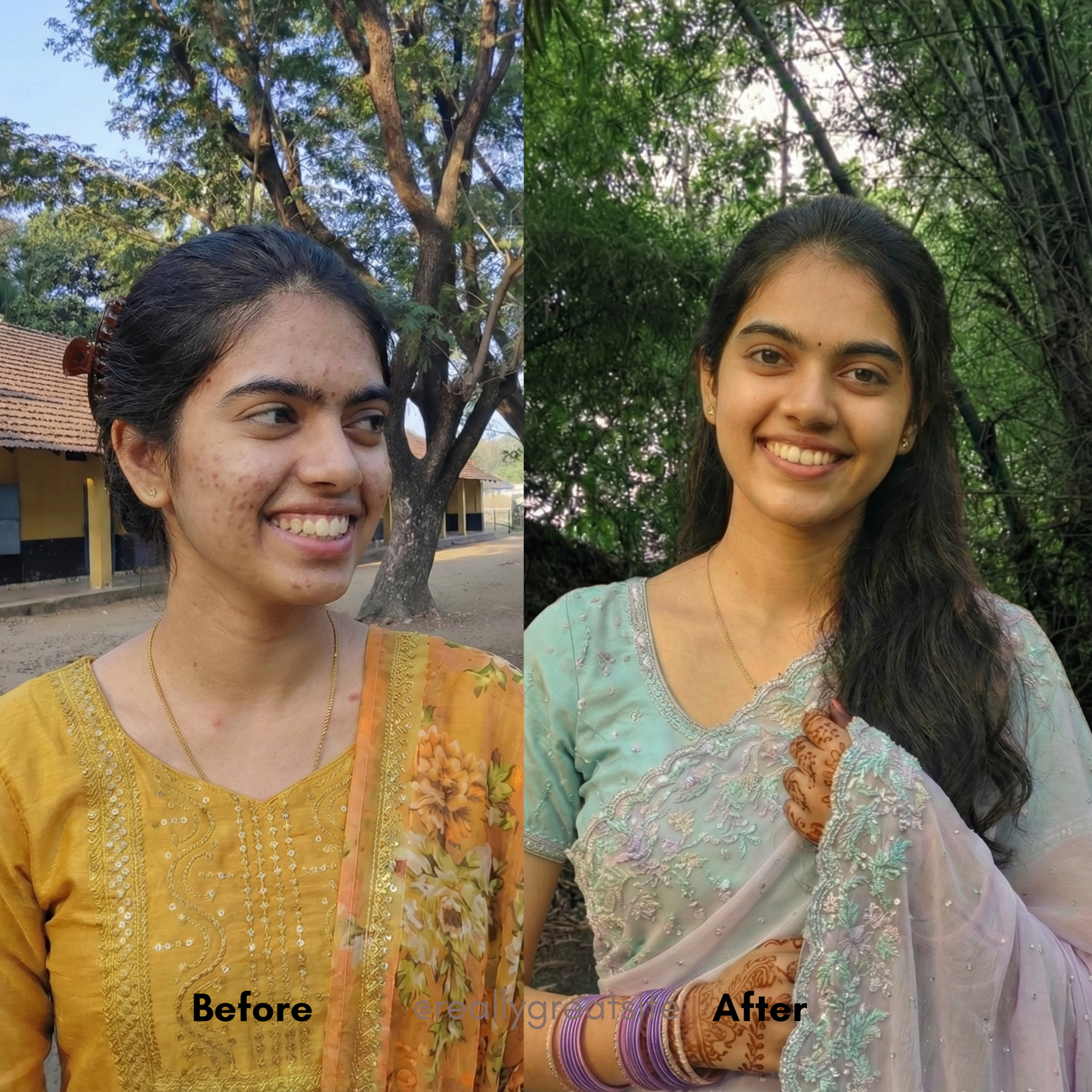 Vedhascents -Aqua Leaf-Premium Natural Face Wash|Best Face Wash for Oil, Acne & Pimple Control|Deep Cleansing & Glow Boosting-100ml