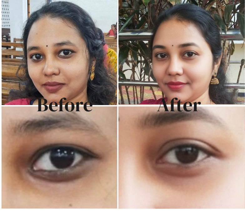 Vedhascents Premium Natural Under Eye Cream - 15gm
