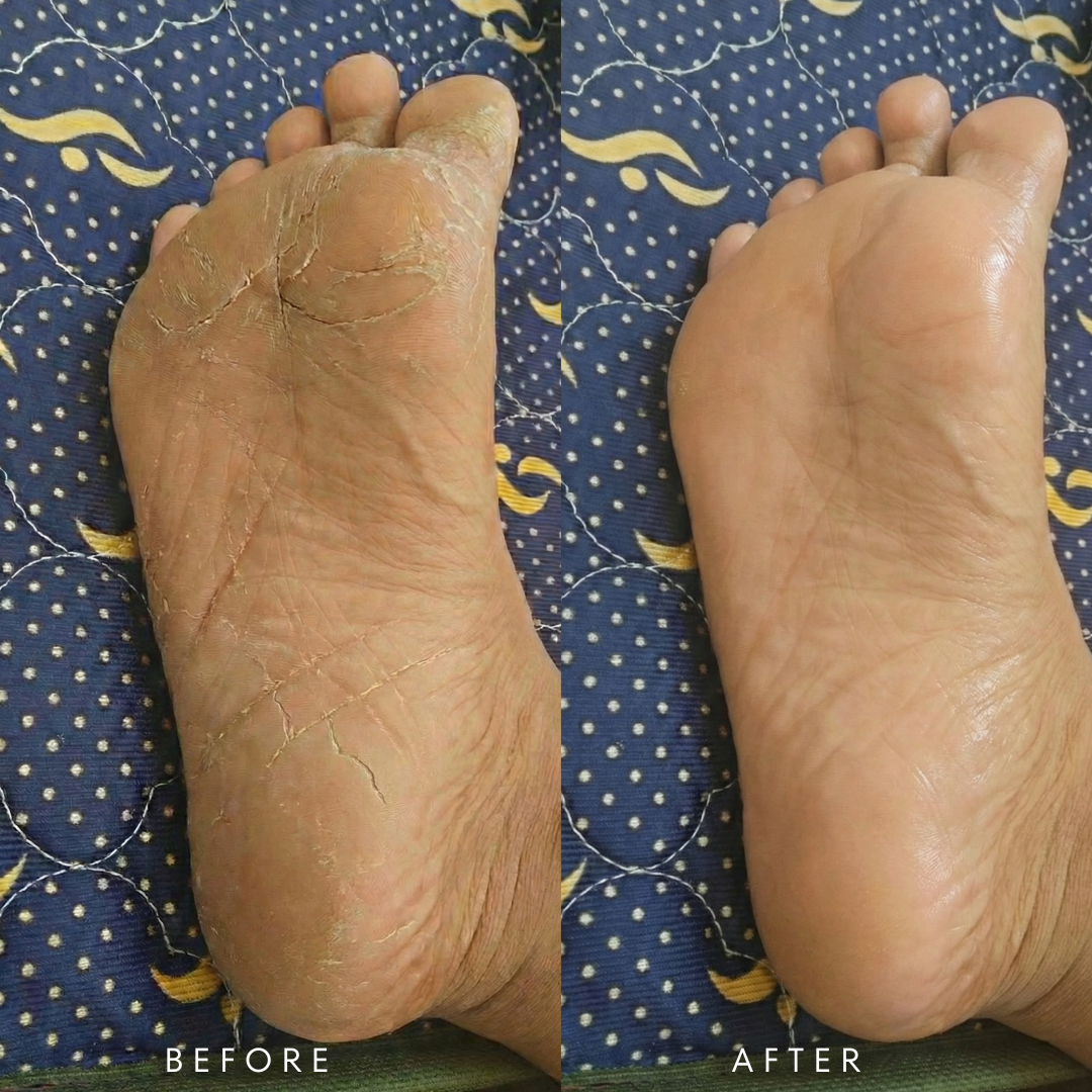 VedhaScents Pure Sole Premium Natural Foot Cream|Ayurvedic Cream for Cracked Heels, Dry Feet & Rough Skin Repair | Deep Moisturizing Heel Softening Cream With Natural Ingredients for Intense Hydration, Healing & Smooth Feet (50g)